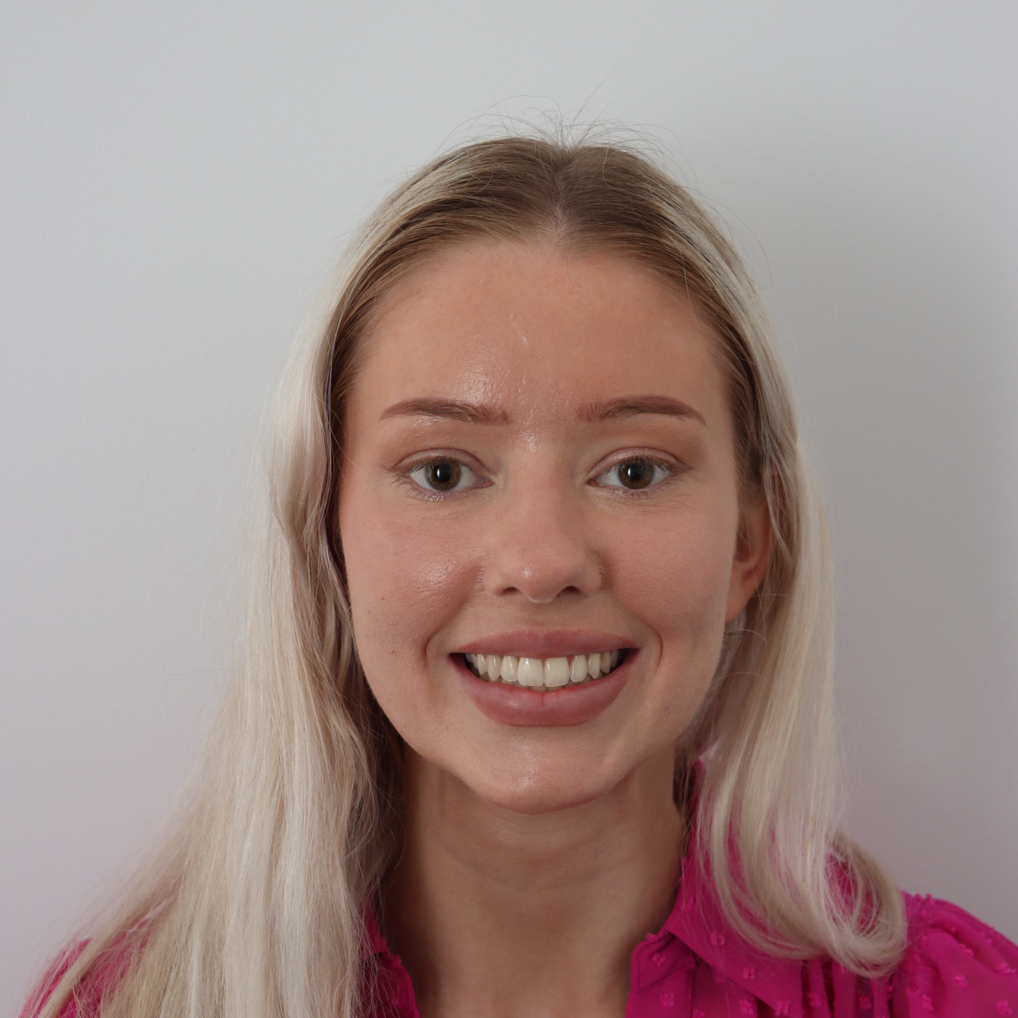 After Invisalign treatment result