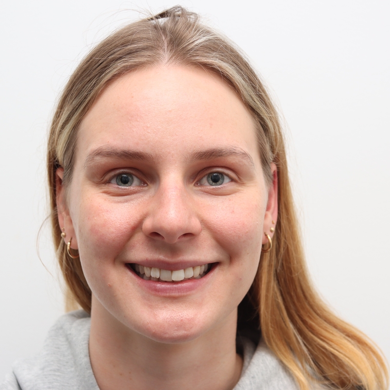 Before Invisalign treatment result