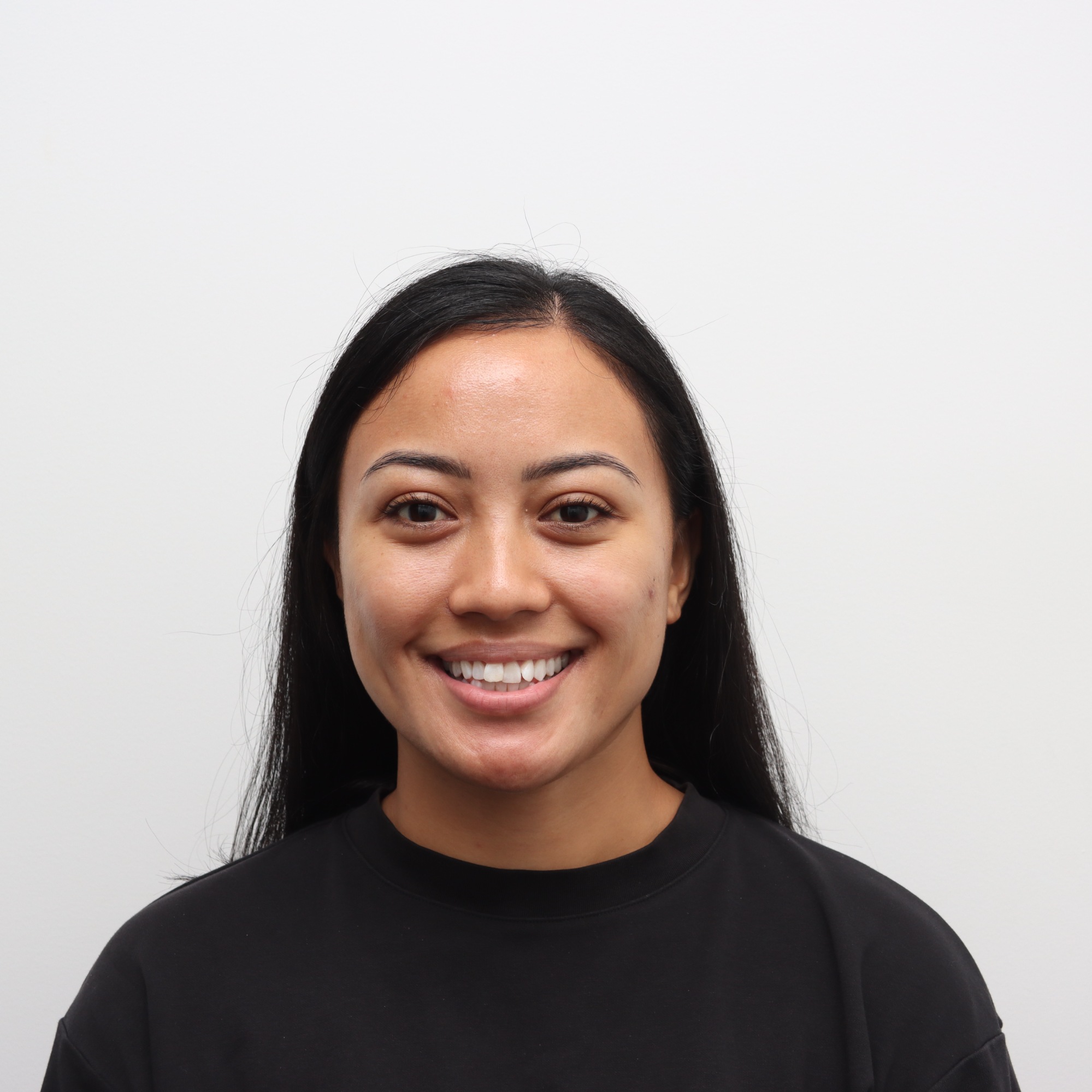 Before Invisalign treatment result